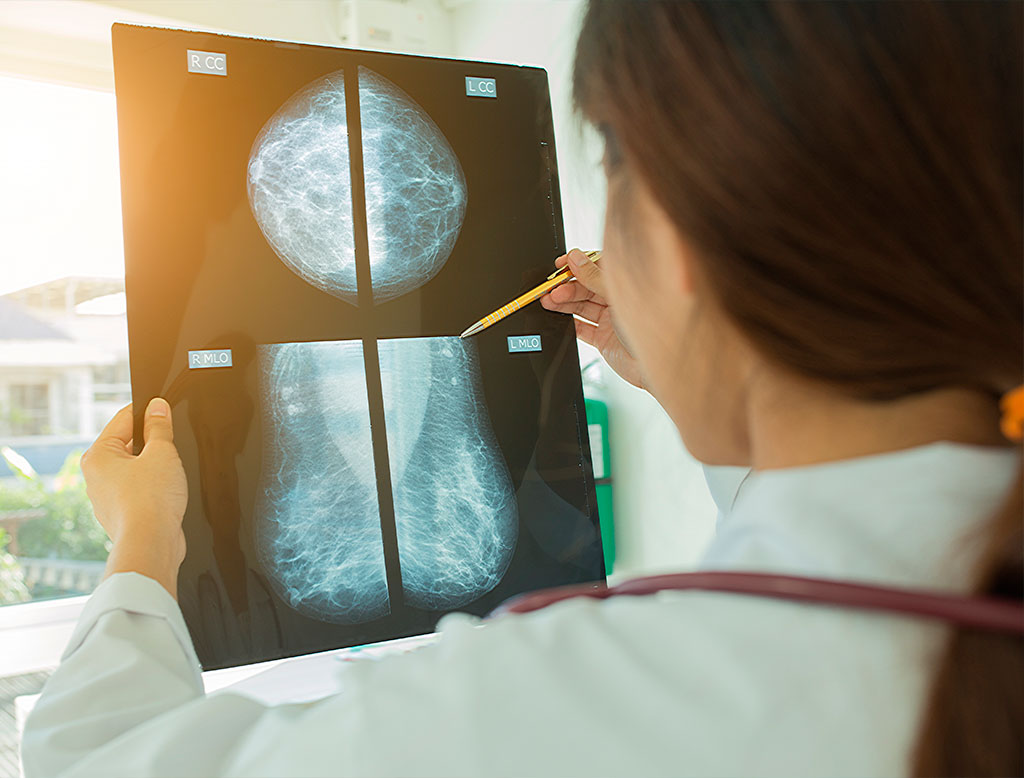 exames preventivos câncer de mama